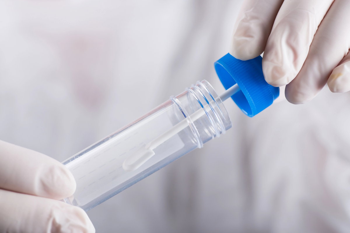 Teste imunoquímico fecal: entenda sua importância e como realizá-lo