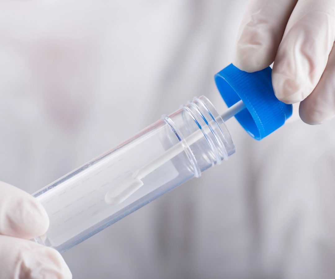 Teste imunoquímico fecal: entenda sua importância e como realizá-lo