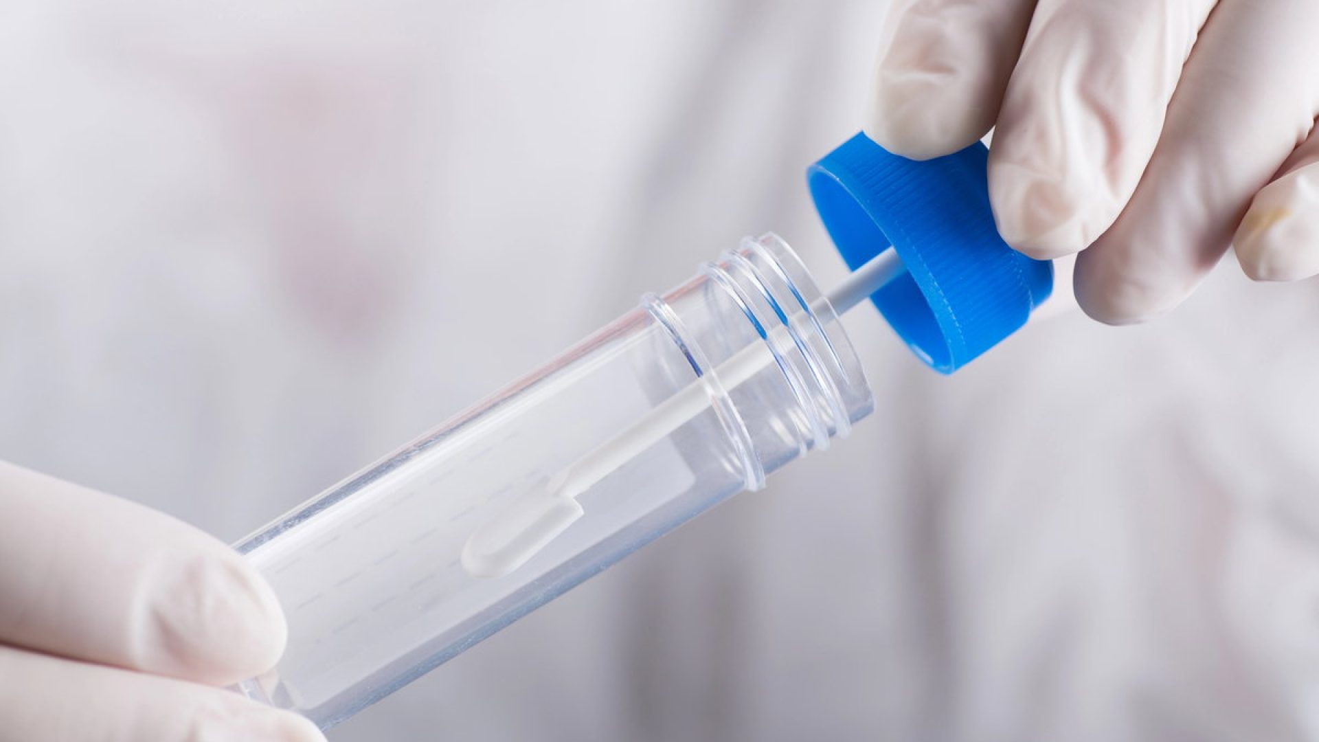 Teste imunoquímico fecal: entenda sua importância e como realizá-lo